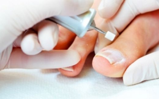 Medikal Ayak Bakımı Nasıl Olur?