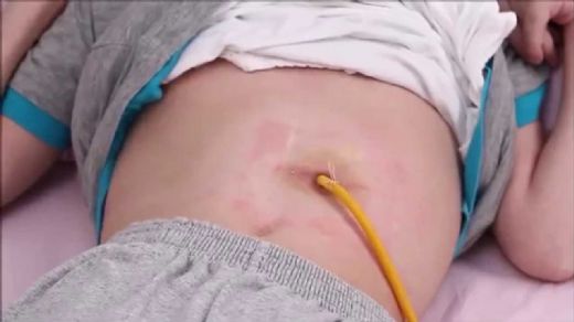 Peg Bakımı Nasıl Yapılır?